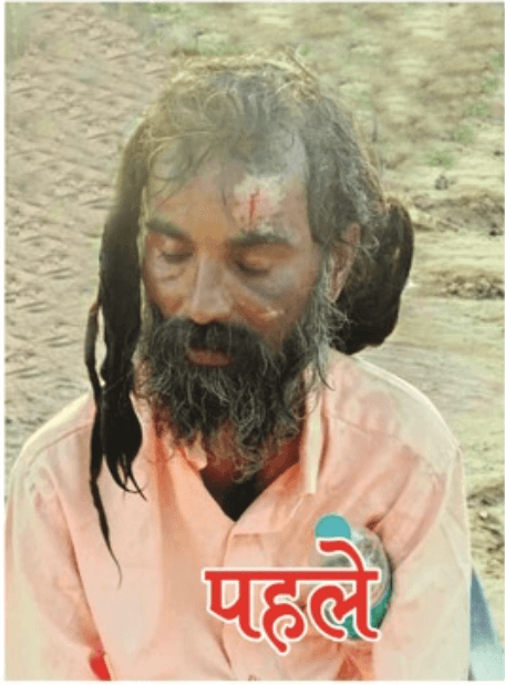 Resident before care at GBSS shelter